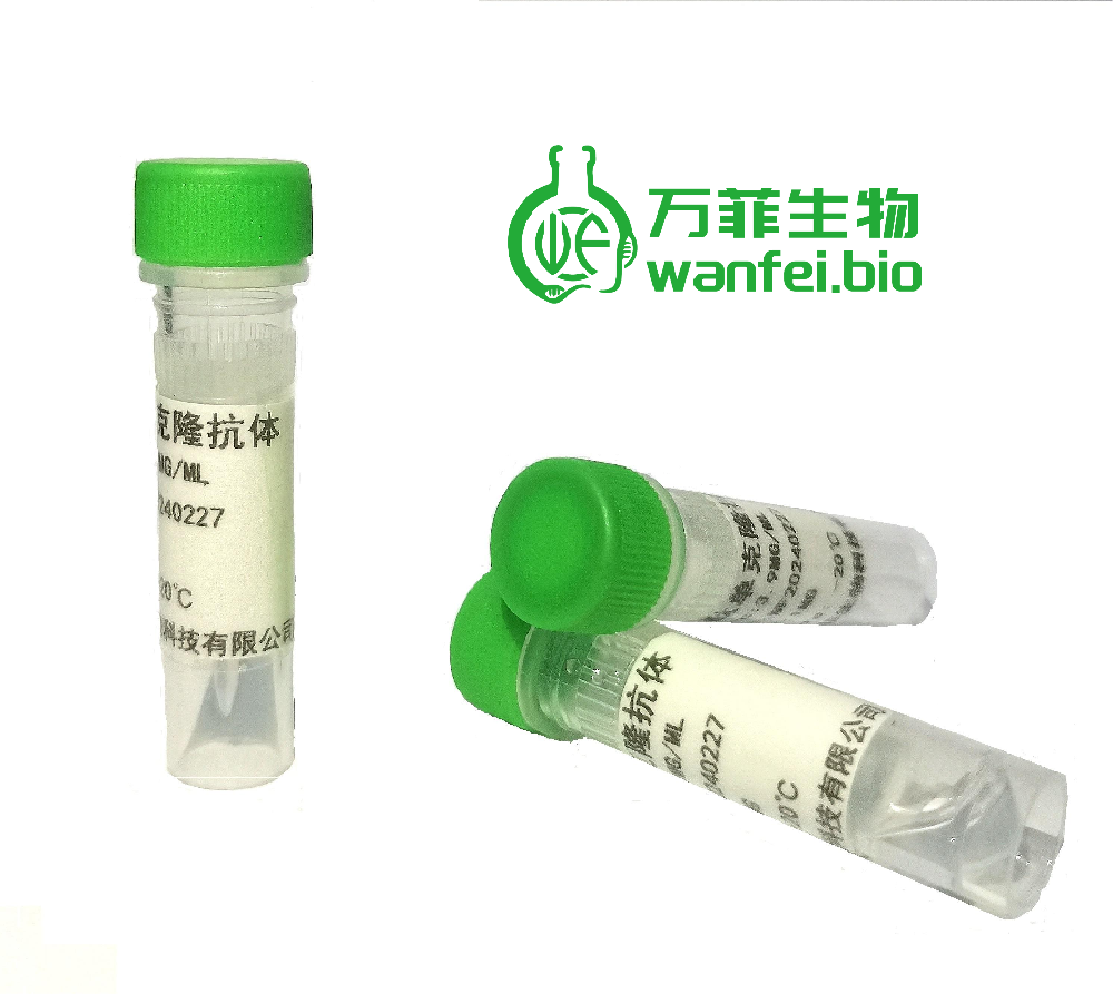 三碘甲状腺原氨酸T3单克隆抗体